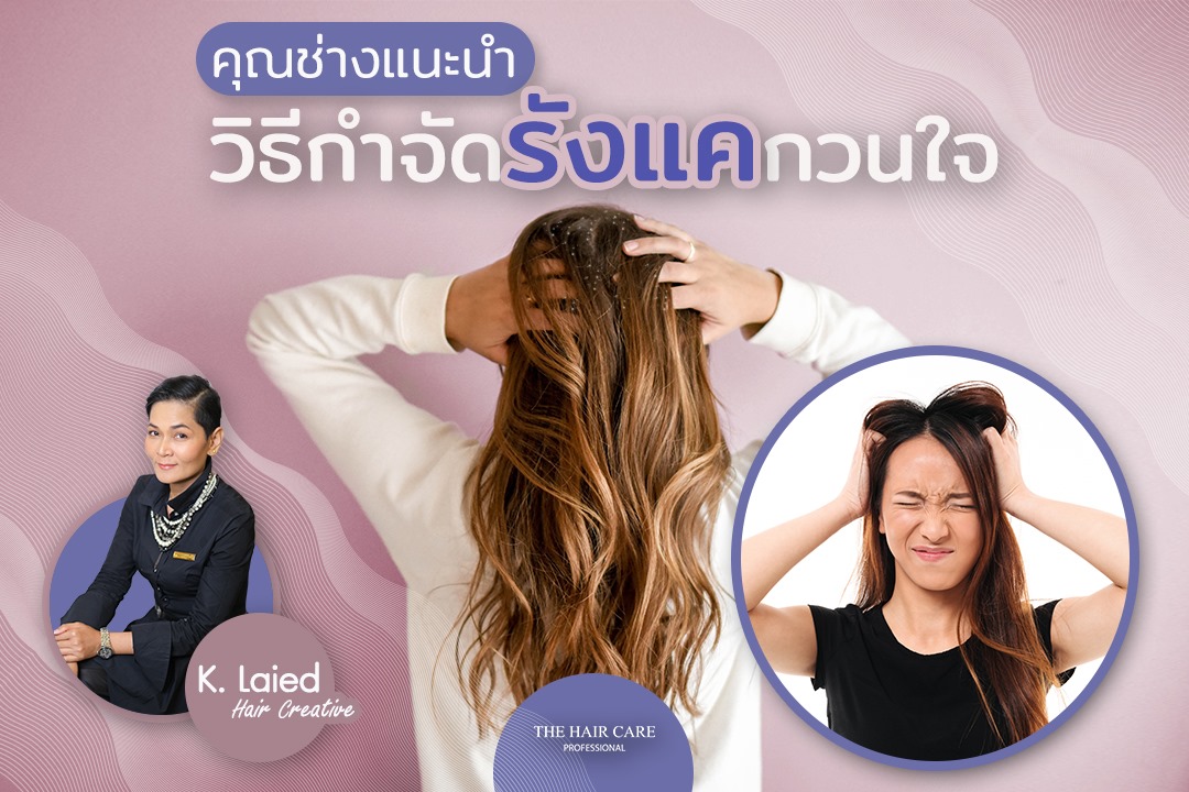 วิธีกำจัดรังแคกวนใจ